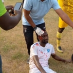 Scars of Hooliganism: Former RTU star Nawass opens up on brutal attack that ended his career