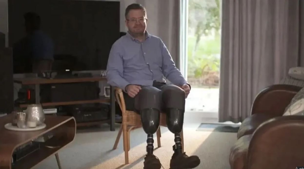 Surgeon jailed after amputation of own legs – MyJoyOnline