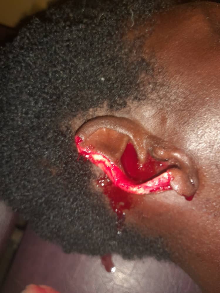 Man ‘chews’ off wife’s ear in a scuffle in Dambai – MyJoyOnline