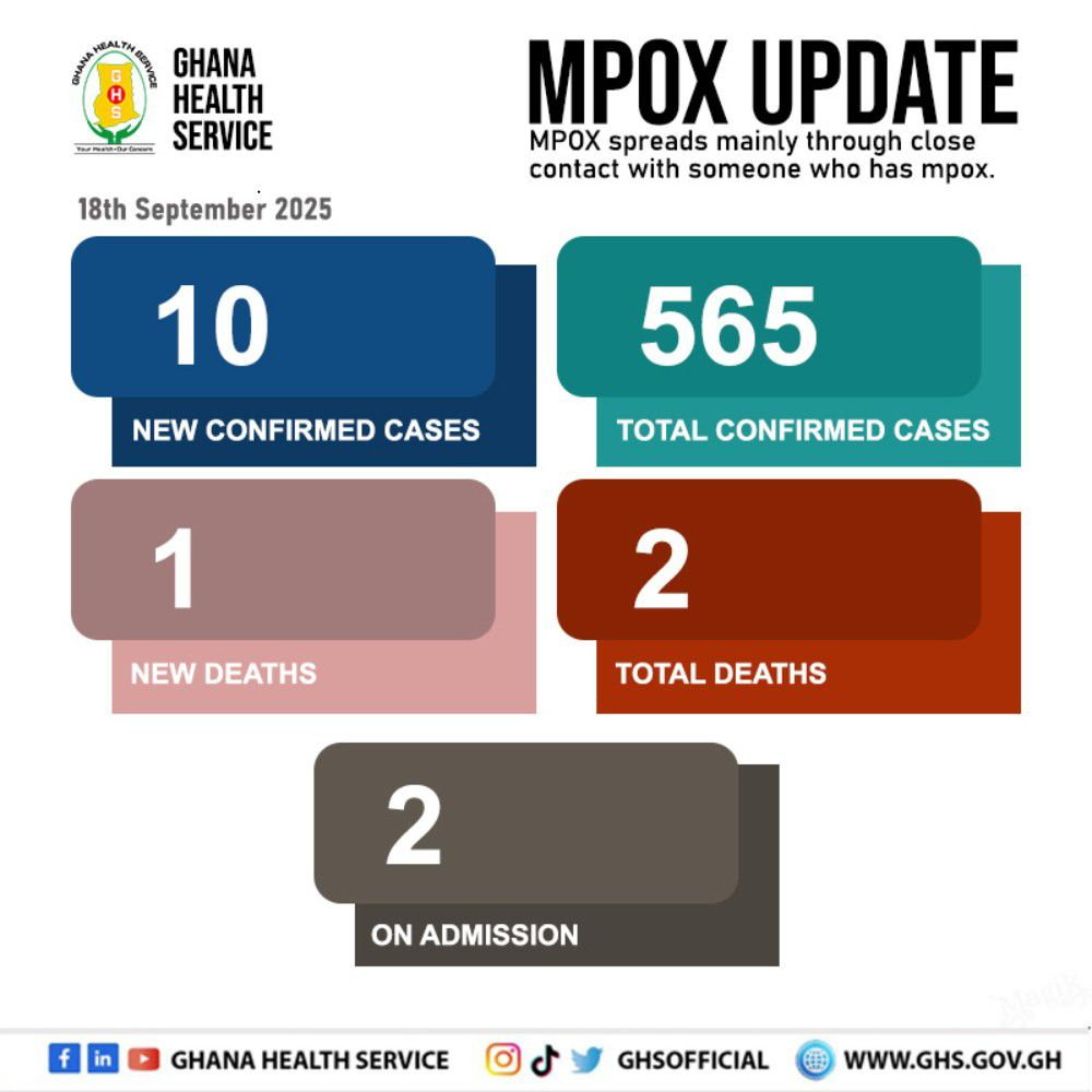 Mpox: Total confirmed cases hit 565 – MyJoyOnline