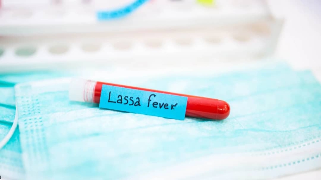 Lassa fever vaccine expected by 2032 – MyJoyOnline