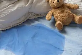 Health committee condemns burning of 7-year-old girl over bedwetting – MyJoyOnline