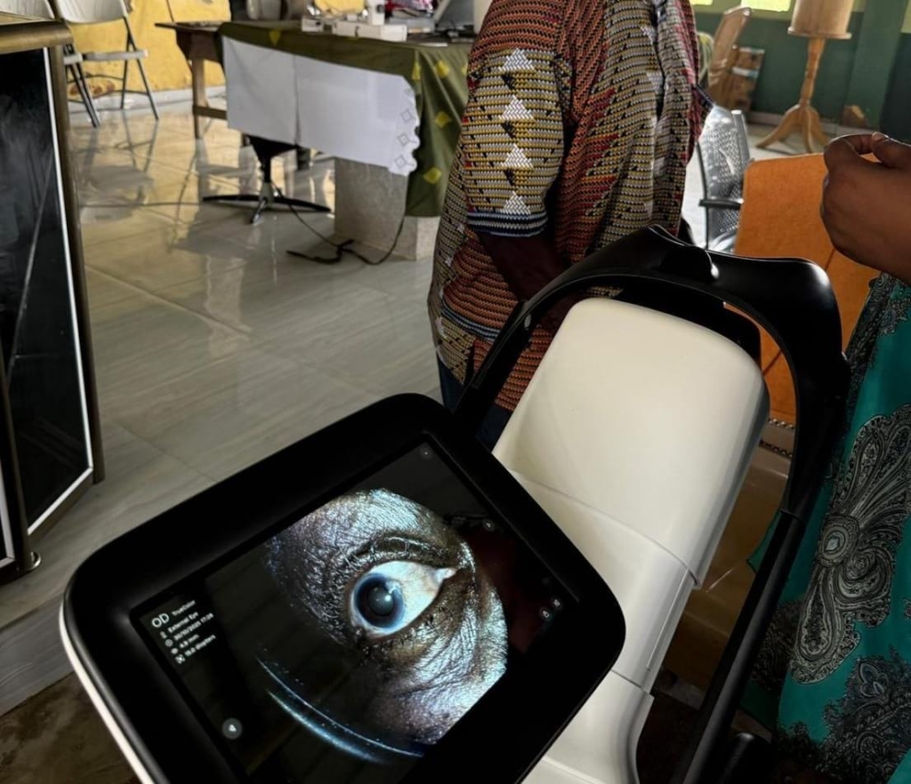 Licht Voor Het Oog, Mind-the-Gap, Ghana organise eye screening for Adzato electoral area – MyJoyOnline