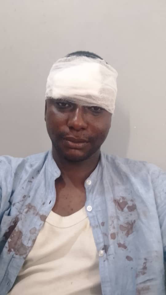Three Multimedia Group journalists injured in crash during illegal mining coverage with EPA Three Multimedia Group journalists injured in crash during illegal mining coverage with EPA