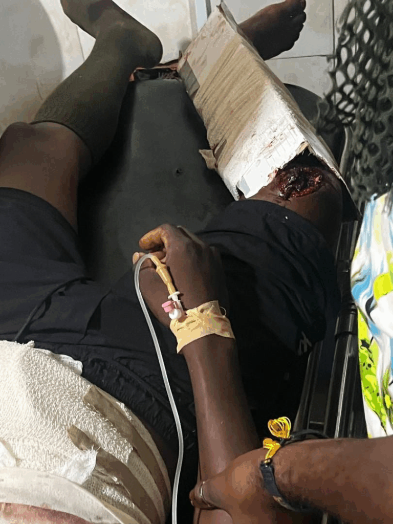 Two immigration officers ambushed and shot in Upper East Region’s Tempane district Two immigration officers ambushed and shot in Upper East Region’s Tempane district