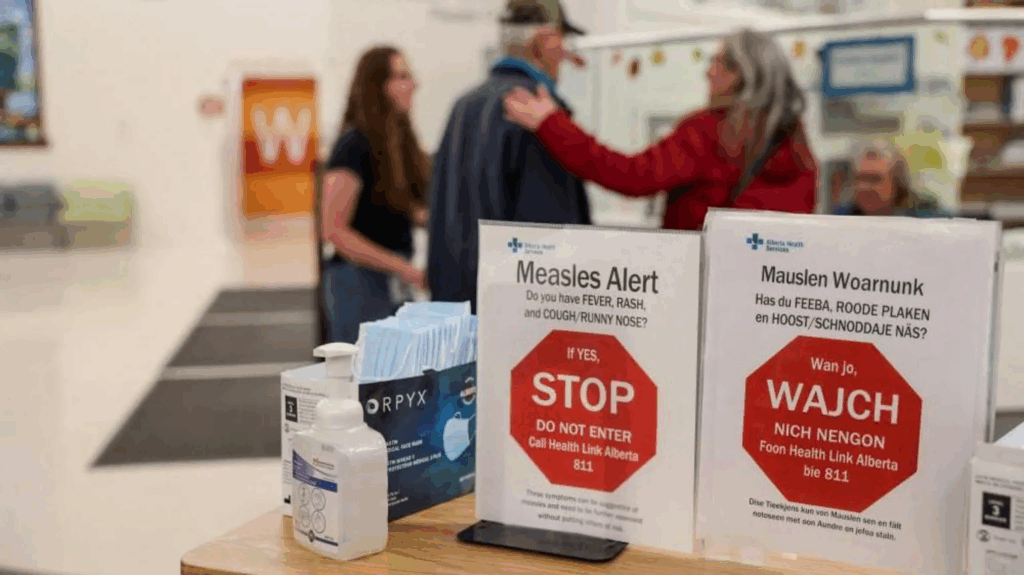 Canada loses its measles-free status, with US on track to follow – MyJoyOnline