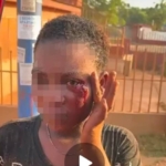 Police rescue young woman, arrest partner in viral domestic abuse case