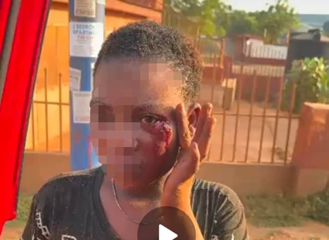 Police rescue young woman, arrest partner in viral domestic abuse case – MyJoyOnline