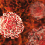 Leukaemia now accounts for 25% of childhood cancers - Haematologist tells Joy News Leukaemia now accounts for 25% of childhood cancers - Haematologist tells Joy News