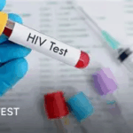Berekum West rank 10th in HIV/AIDS cases Berekum West rank 10th in HIV/AIDS cases