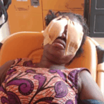 Suspect remanded over stabbing of woman in both eyes; victim to seek treatment abroad