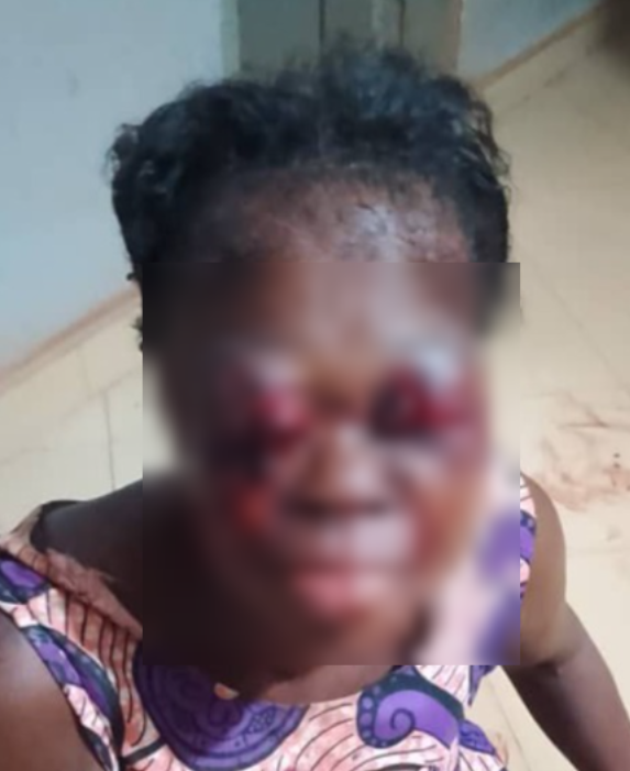 Man arrested for allegedly stabbing woman in both eyes with scissors at Sefwi Abrokofe