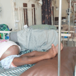 MahamaCares covers GH¢46,000 kidney cancer treatment for four-year-old at Ho Teaching Hospital