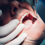 Your mouth on weed is nothing to smile about