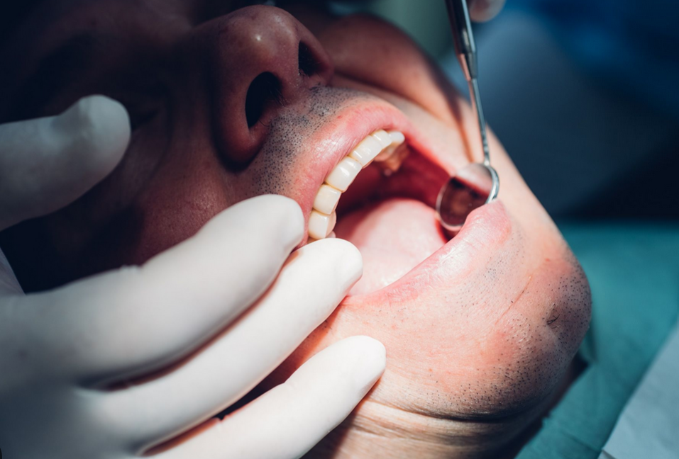 Your mouth on weed is nothing to smile...