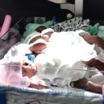 Surrogate mother delivers quadruplets - Rare in assisted reproductive technology