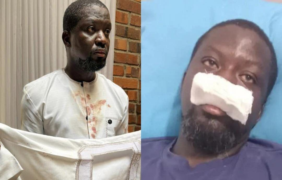 The  Ibrahim Mahama brutality: Why Ghana needs independent police oversight