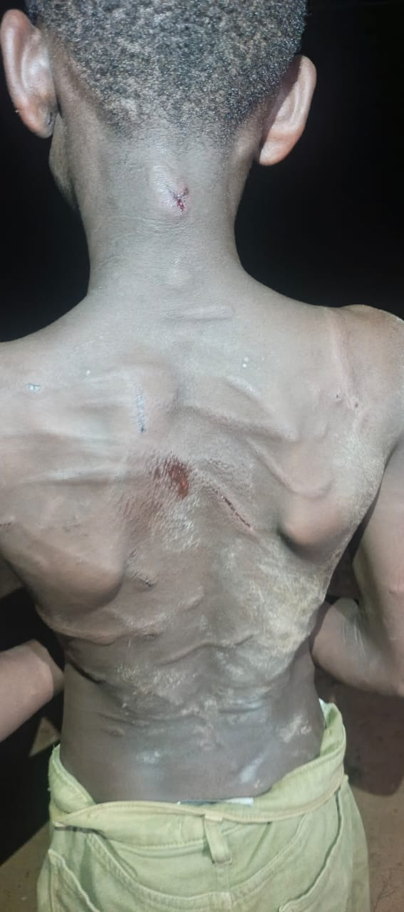 Mother allegedly assaults 12-year-old daughter over plantain sale in Abrabra