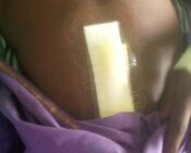 Landguards stab resident at gov’t project site in Awutu Oshimpo