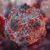 What to know about hantavirus, suspected virus outbreak on Atlantic cruise ship 