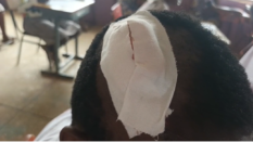 Two BECE candidates injured in Nkwanta South accident, return to sit exams