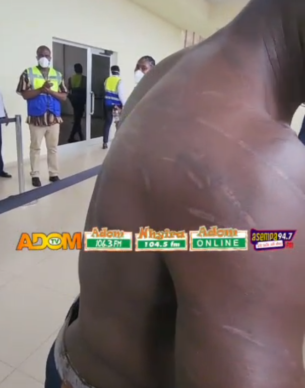 “I suffered beatings, look at my marks” –...