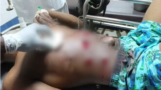Nkwanta crisis: Fresh gunfire sends residents fleeing; 26-year-old rider shot