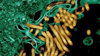 New outbreak of Ebola kills 65 in eastern DR Congo