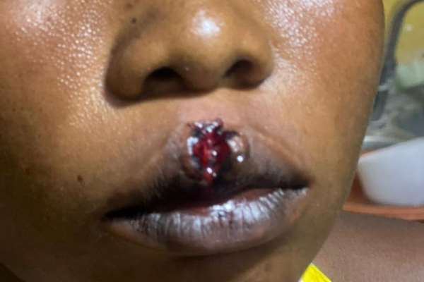 Woman, 24, allegedly attacked during...