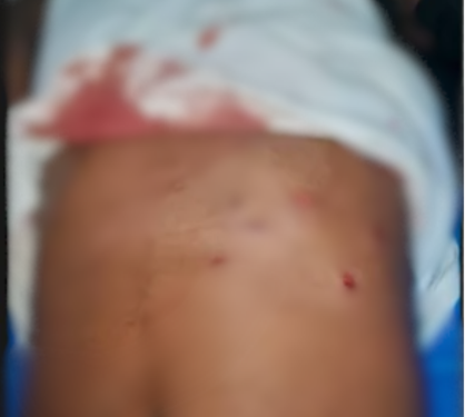 Two injured as armed robbers attack mobile ...