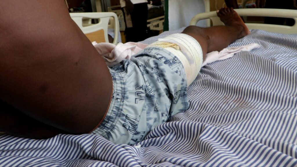 Stray bullet shatters bystander's right leg in Wechiau clashes, MP demands swift justice