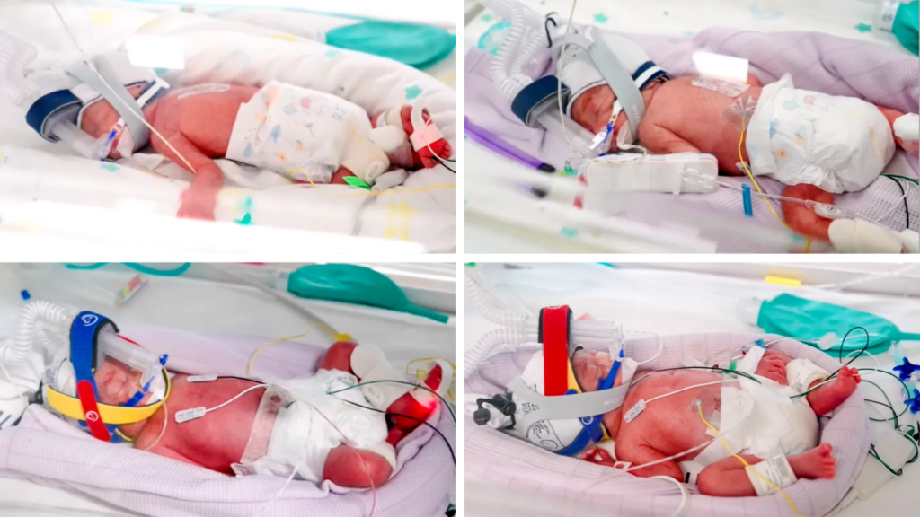 Rare identical quadruplets born in...