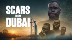 Scars From Dubai: 28-year-old fights to rebuild his life after acid attack by a Ghanaian disfigured him