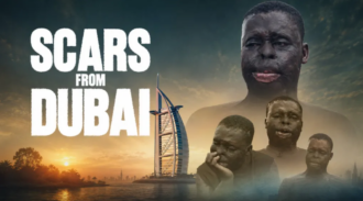 Scars From Dubai: 28-year-old fights to rebuild his life after acid attack by a Ghanaian disfigured him