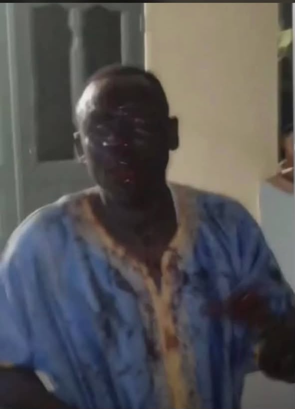 Obuasi SHS headteacher hospitalised after students assaulted him for allegedly burying a fetus