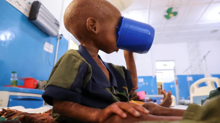 Somalia child hunger crisis deepens after...