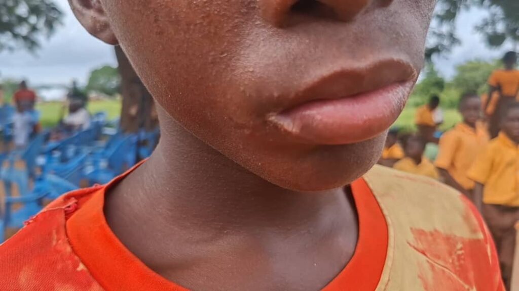 Mysterious illness leaves children...