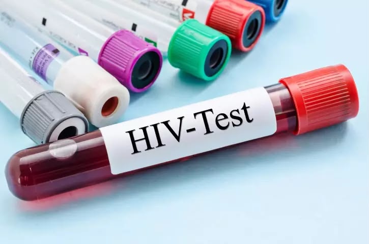 HIV status cannot be used to deny...