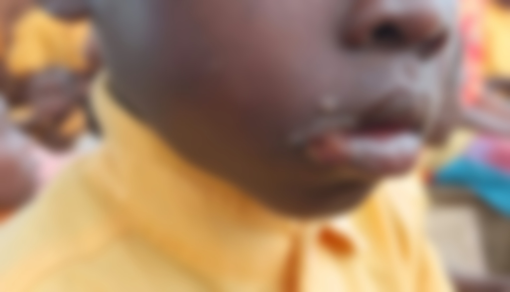 Mafi Kope residents appeal for urgent medical intervention over illnesses affecting children, adults Mafi Kope residents appeal for urgent medical intervention over illnesses affecting children, adults